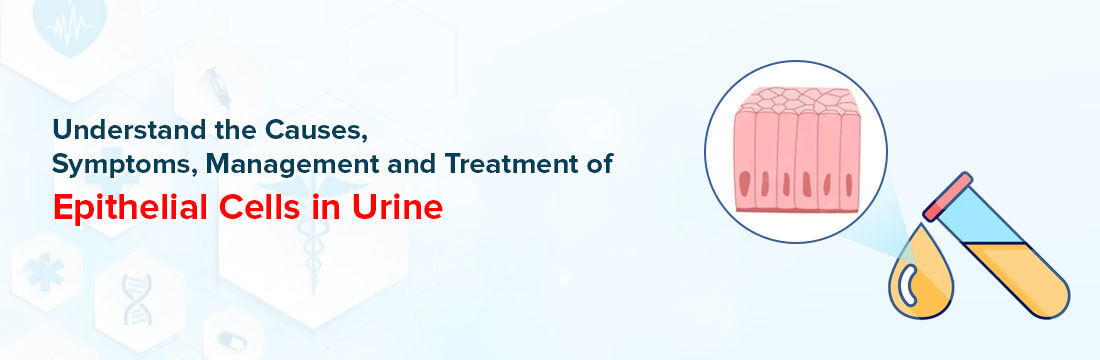 Understand The Causes, Symptoms, Management and Treatment of Epithelial Cells in Urine
